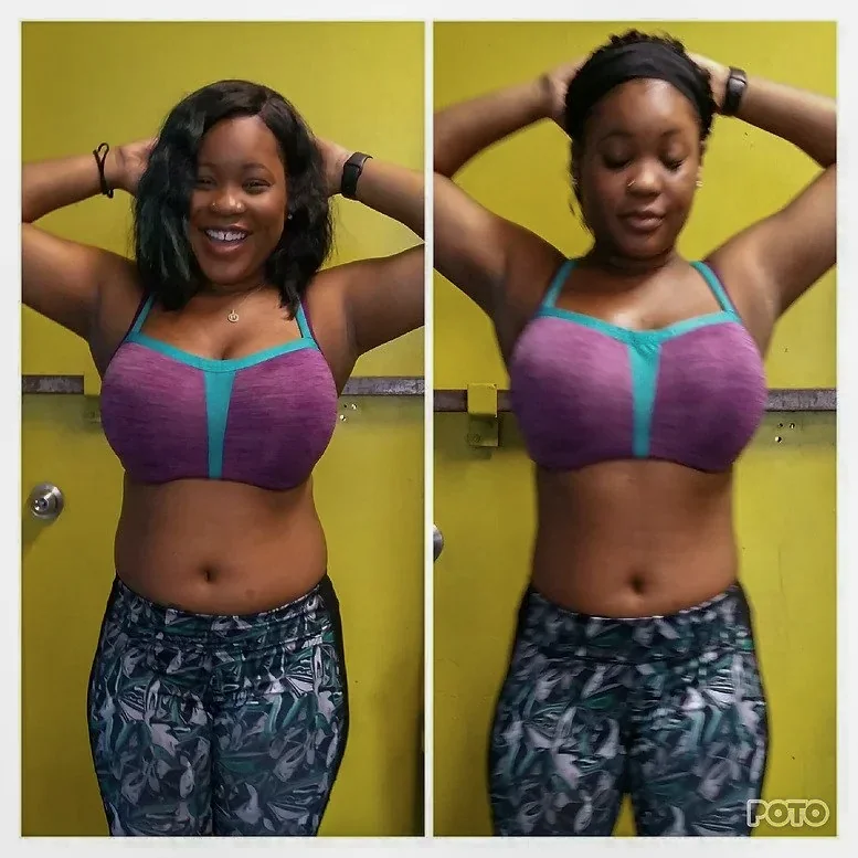 Nawara before and after comparison
