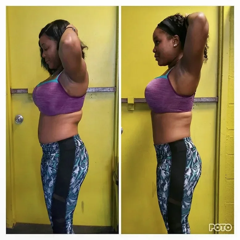 Nawara before and after comparison