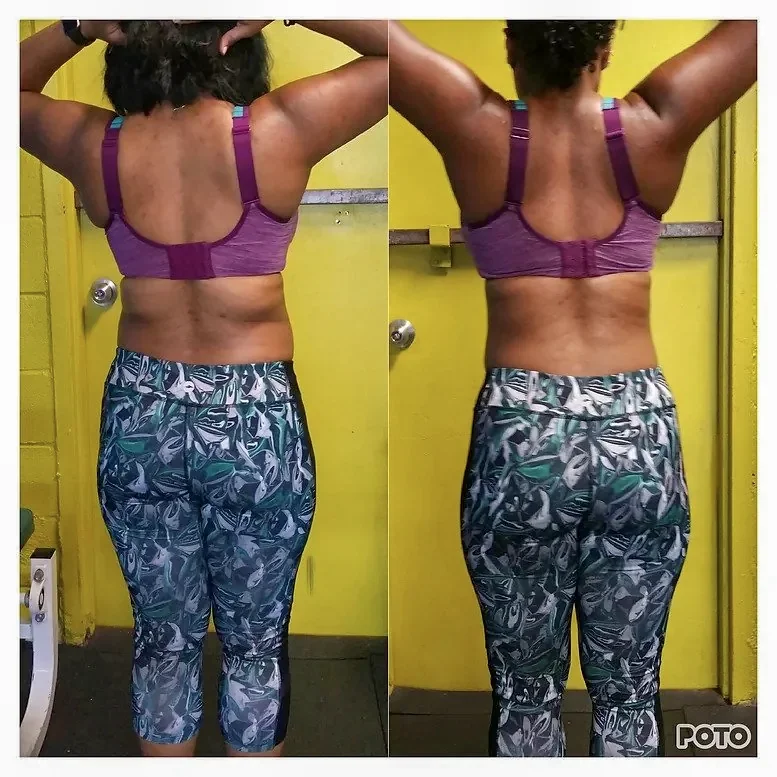 Nawara before and after comparison